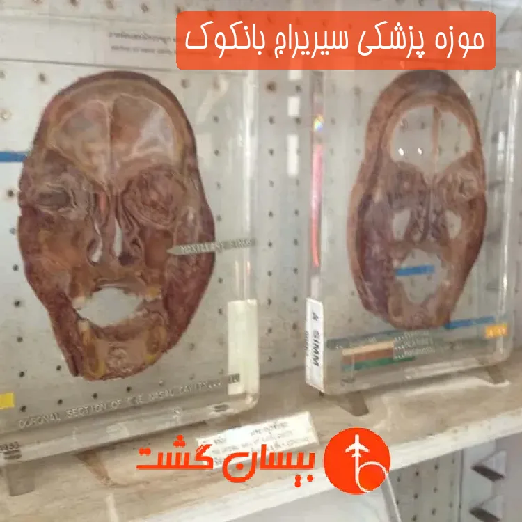 موزه پزشکی سیریراج بانکوک